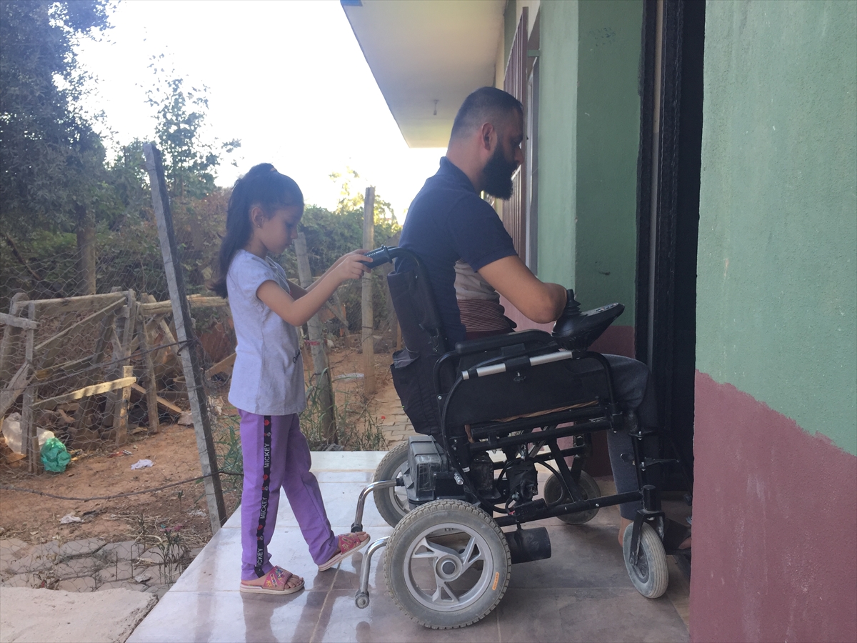 Bacağını ve kollarını kaybeden kişi protez desteğiyle hayata tutunmak istiyor